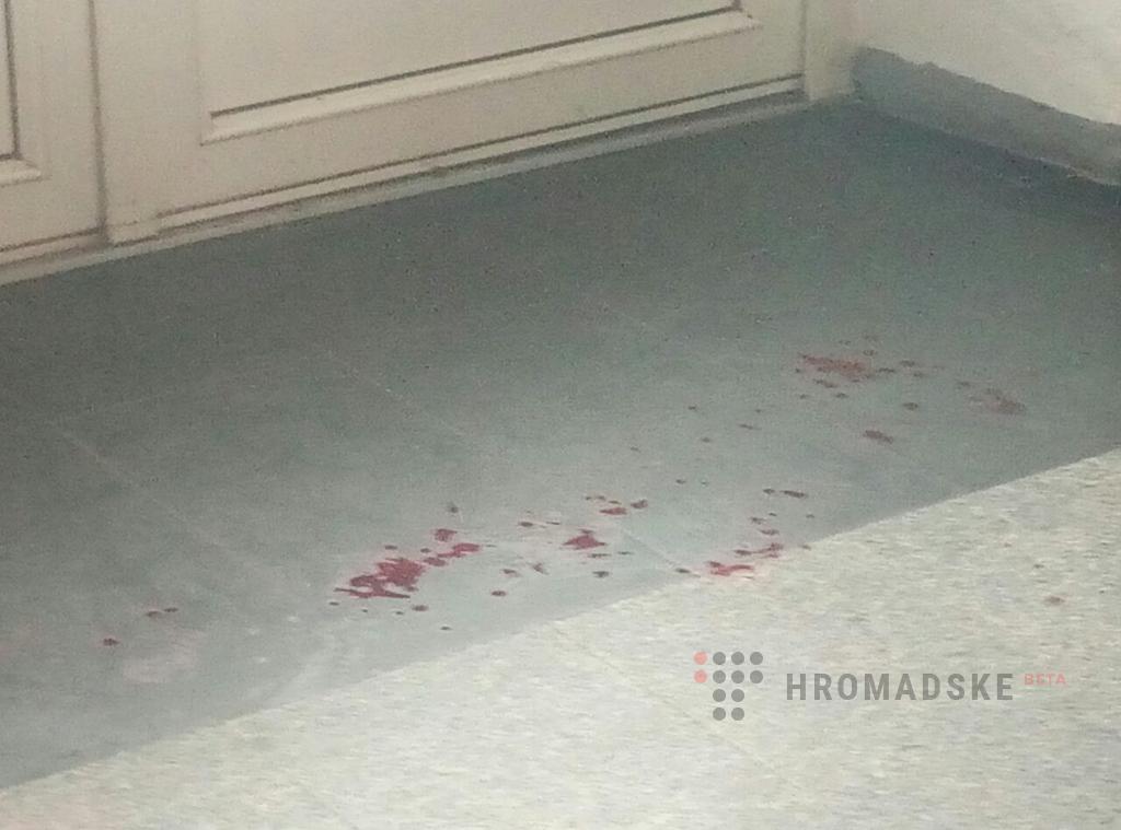 В Полтаве на вокзале мужчина начал кричать и бить себя ножом в живот (фото)