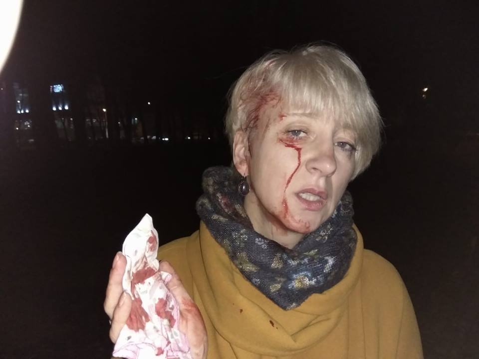 В полтавском парке избили судью Ларису Гольник (фото, дополнено)