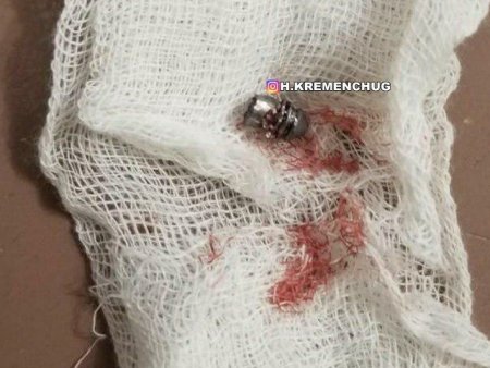 В Кременчуге неизвестный стрелок ранил парня (фото)