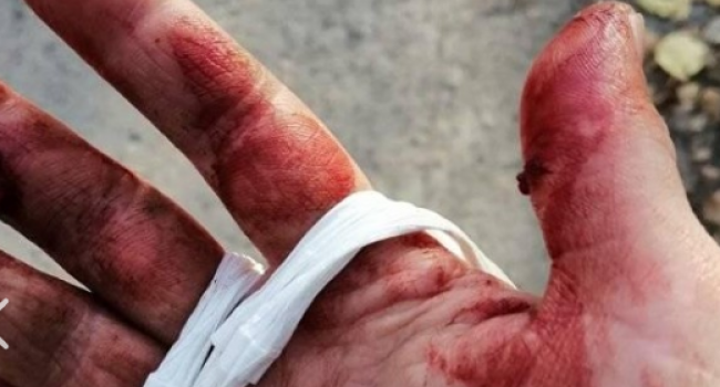 На Полтавщине собака напала на женщину с питомцем - соцсети