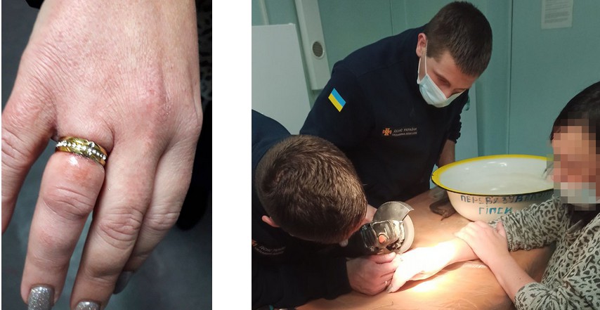 Спасатели помогли женщине снять кольцо с пальца