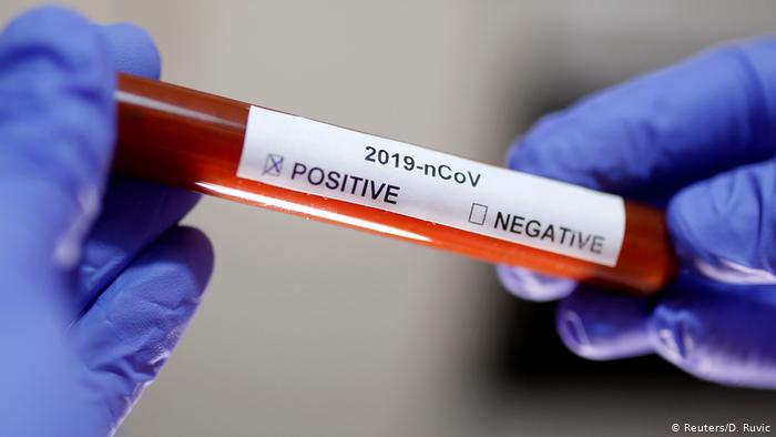 На Полтавщине за минувшие сутки зарегистрировано 293 новых случаев заболевания коронавирусом