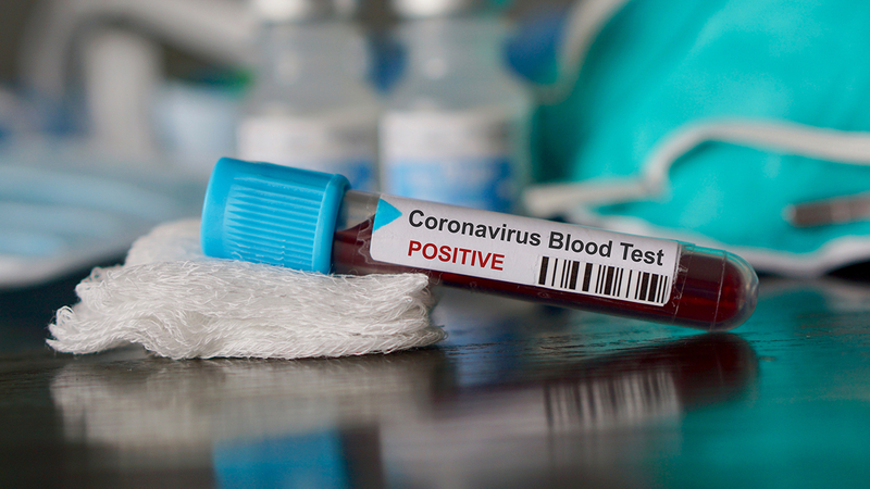 В Украине - еще два случая коронавируса