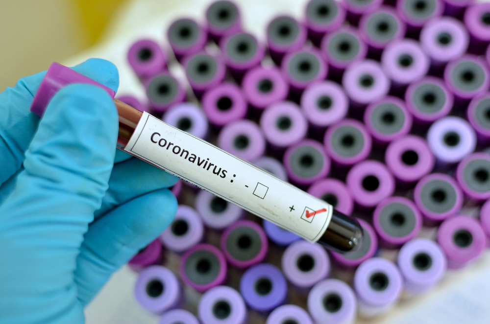 В Украине - 47 случаев коронавируса