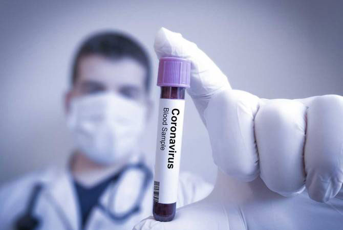 Данные о распространении коронавируса в Полтаве на 24 февраля